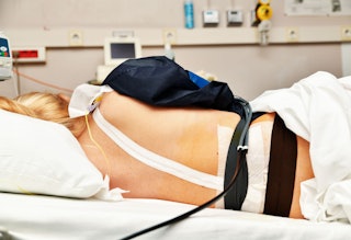 Woman in labor lying down on a bed with an epidural 
