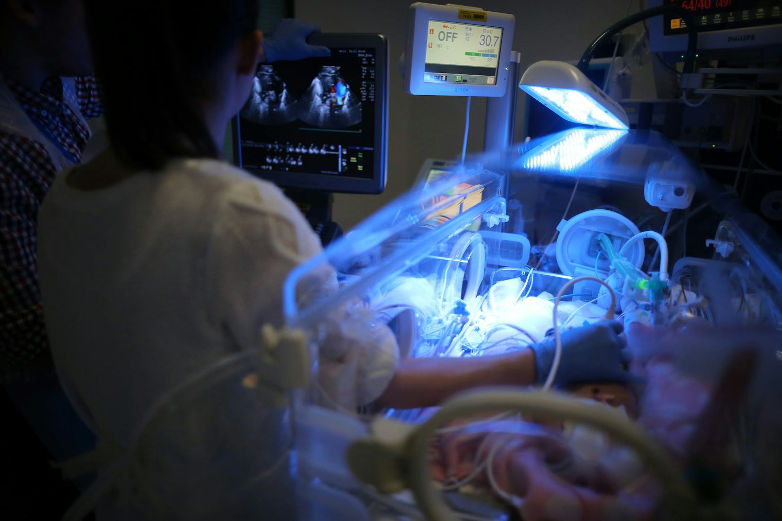 This Is How Much A NICU Stay Will Cost Under The BCRA
