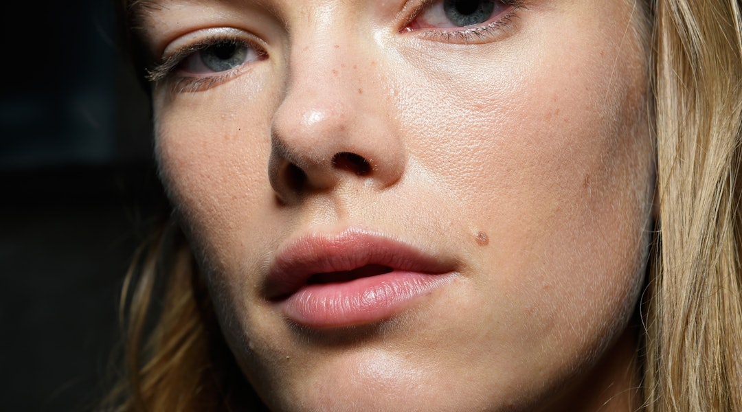 The Cause Of Your Acne Breakouts May Actually Surprise You