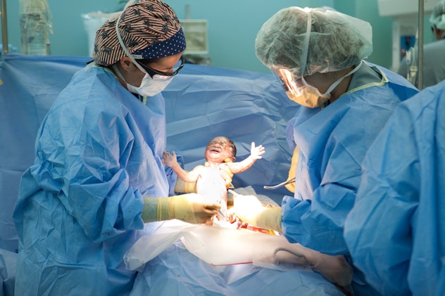 A baby being born via C-section, held by OB and nurse