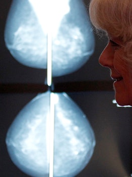 An older woman during her Mammogram screening