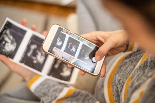 a woman looking at sonogram pics on her phone