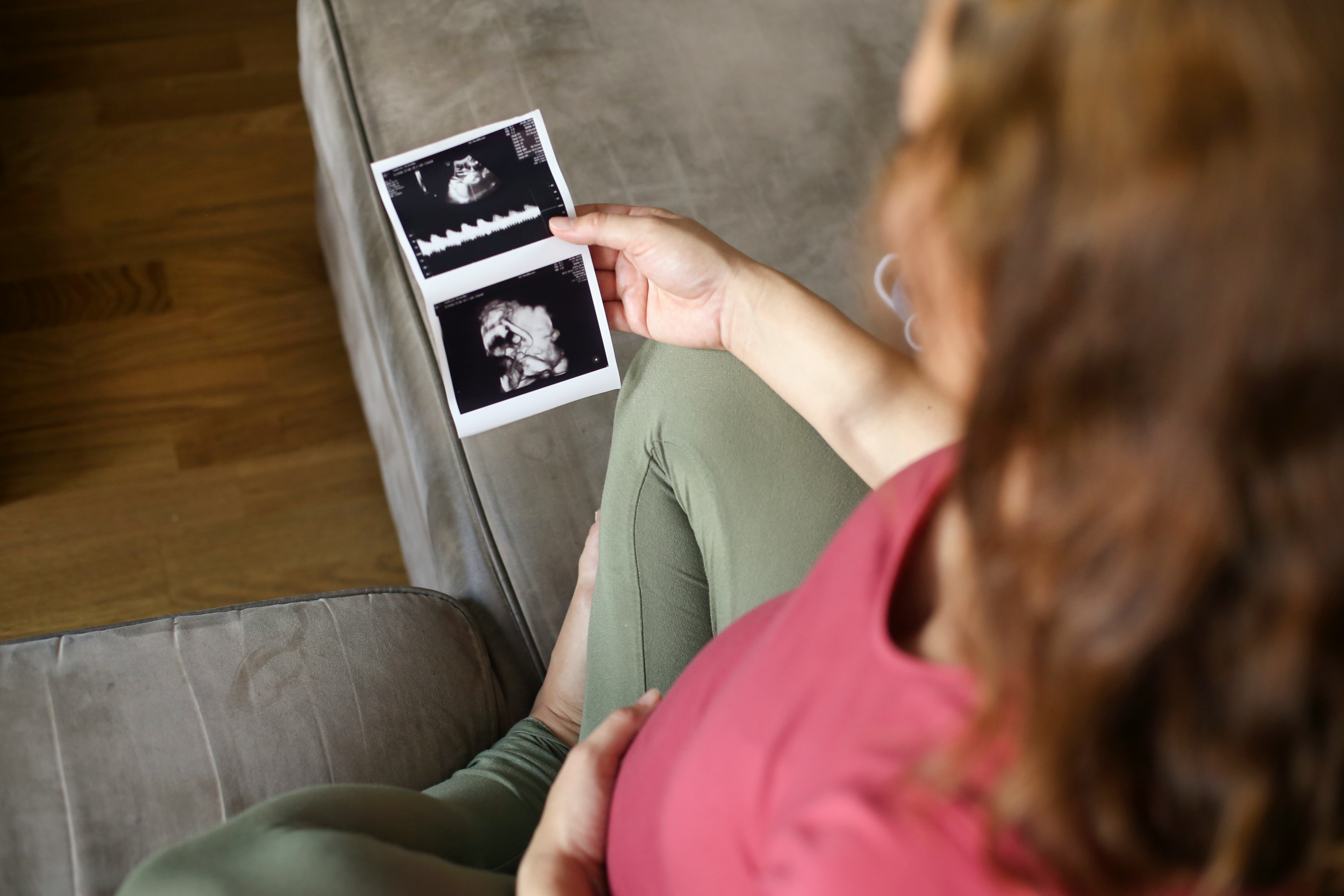 15 Instagram Captions For Your 1st Ultrasound Pic