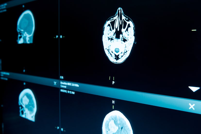 A brain on an electronic scan. Brains perform a lot of clean-up while you sleep, which is why sleep ...