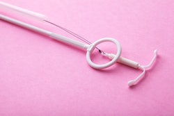 An IUD on a pink background. Here's what an OBGYN wants you to know if your IUD has moved