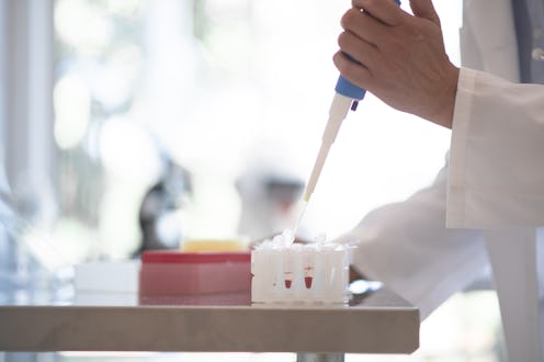 A person in a lab tests samples for a newly discovered strain of HIV