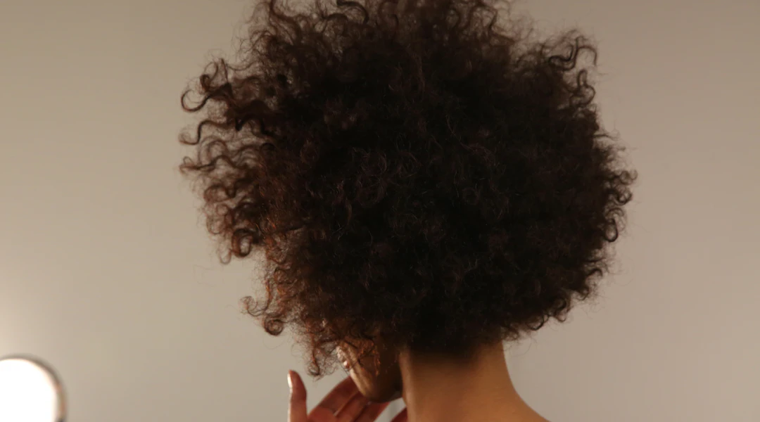 How Microneedling For Hair Loss Leads To A Head Full Of Healthy Hair How Microneedling For Hair Loss Leads To A Head Full Of Healthy Hair