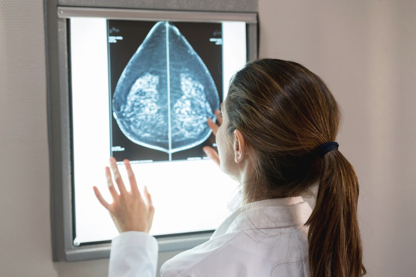 A doctor looks at a scan of breast cancer cells. Breast cancers can grow rapidly. 