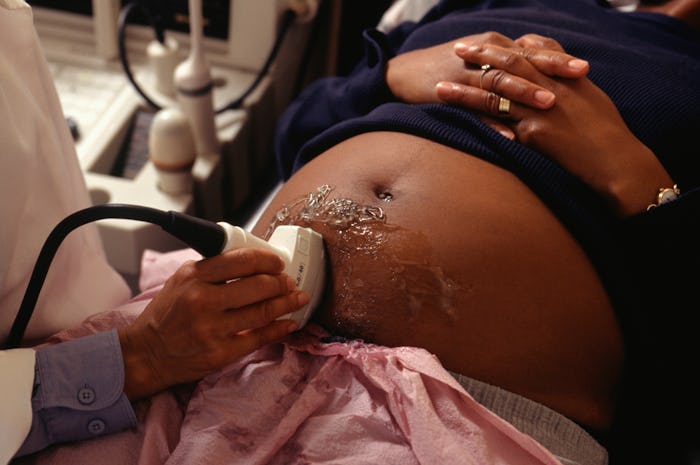 According to the CDC, Black women are 3 to 4 times more likely to die from pregnancy-related complic...