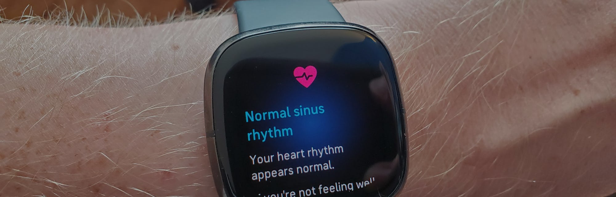 Fitbit Versa smartwatch.