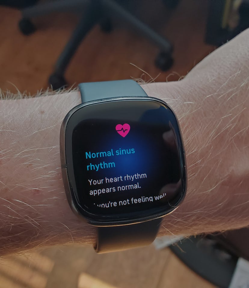 Fitbit Versa smartwatch.