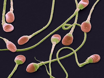 A microscopic image of the oldest sperm in the world