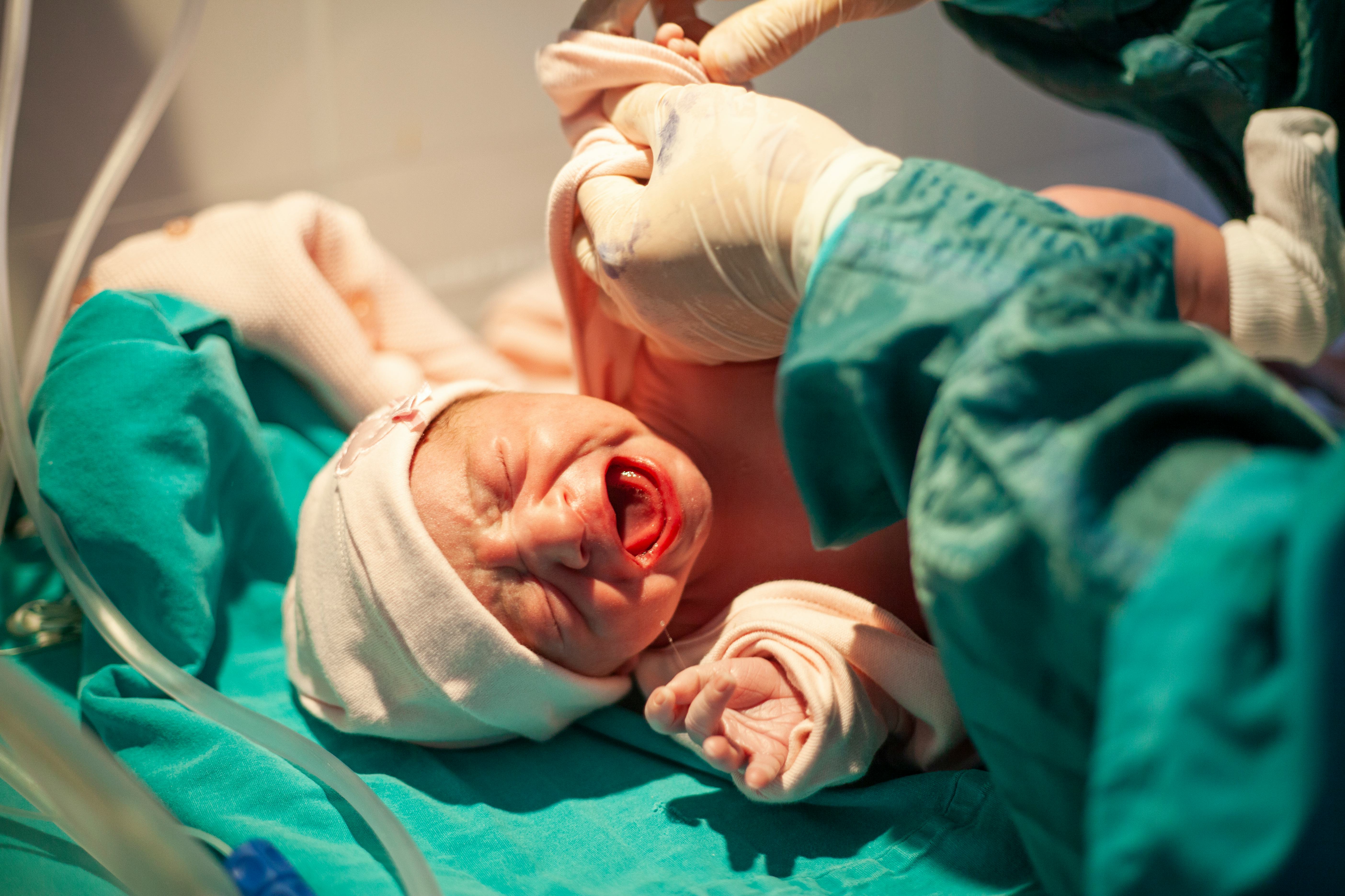 How Soon After Birth Is A Baby Circumcised? Here's What To Expect