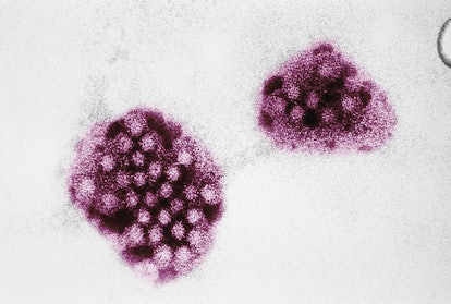 Norovirus, which is not related to the flu, is a highly infectious disease​ that causes gastro-intes...