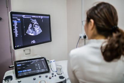 Les échographies sont l'un des meilleurs outils dont disposent les experts pour détecter une grossesse gémellaire.