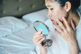 woman checking acne in mirror