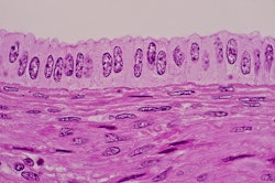 Uterine cells under a slide microscope. Doctors bust these myths about cervical cancer & hpv.