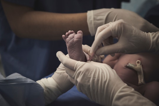 A newborn baby after C-section
