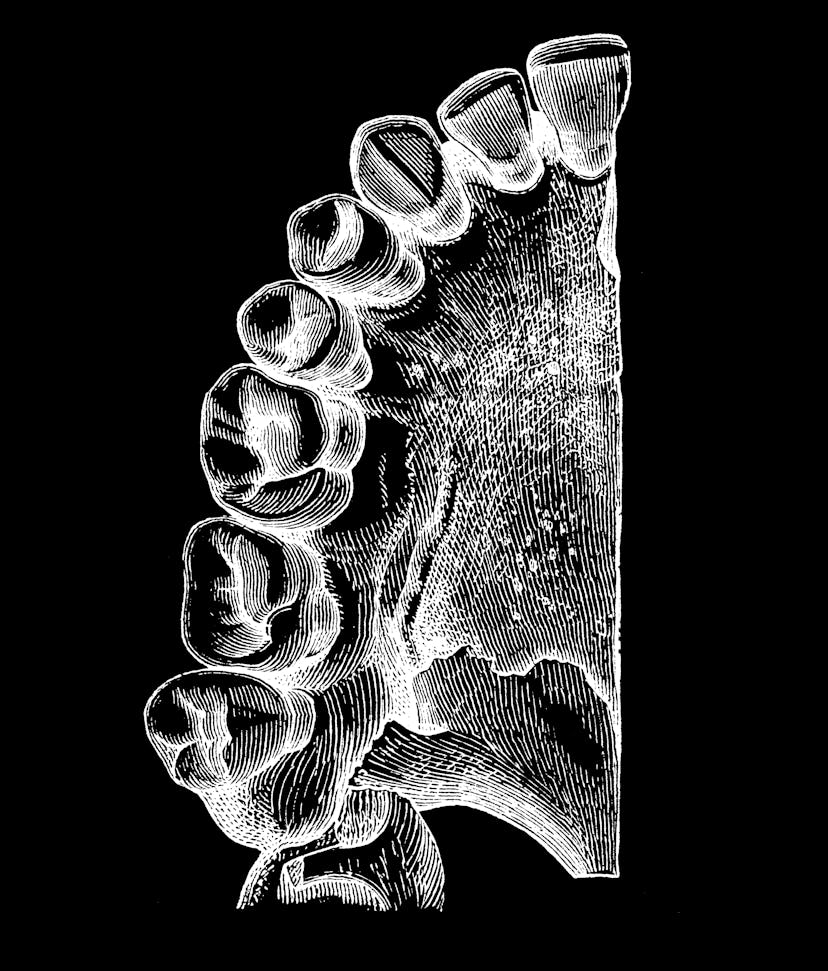 A cross-section of a mouth x-ray. Teeth are vulnerable to fractures if you're stressed.