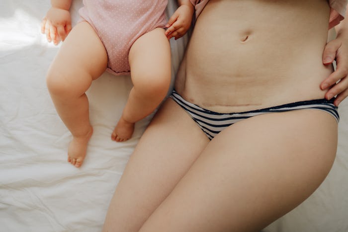 Photo of mother with c-section scar on a belly and her baby lying on the bed