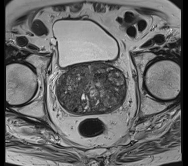 prostate cut through x ray image