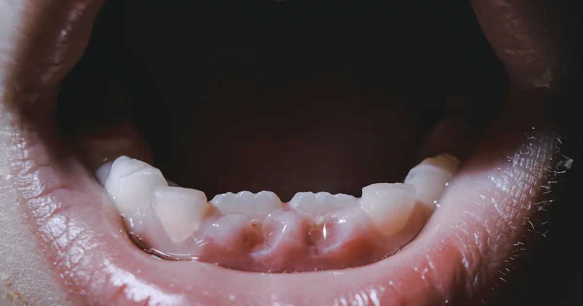 Bussel Teeth Look: Ancient teeth hints at a similarity between Neanderthal and human ...