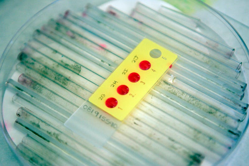 Red dye is used to show the nucleus of any cells in a sample from a rape kit at the LAPD's crime lab...