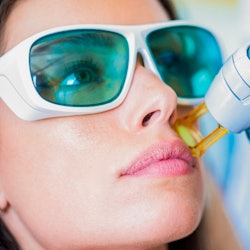 A young woman getting facial hair removed by a laser epilator in a cosmetic center.