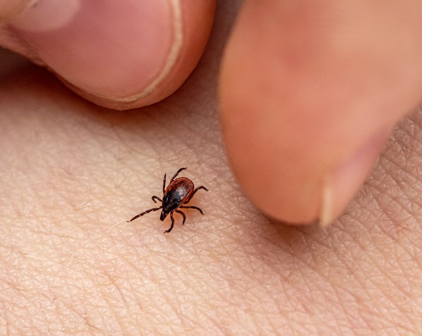 a tick and two fingers, what to do if a tick's head gets stuck your your skin