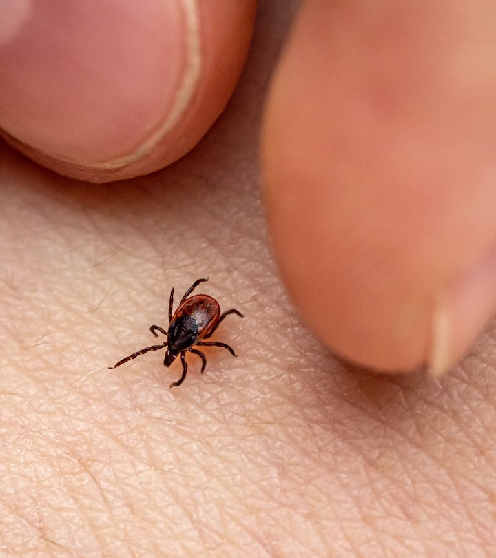 a tick and two fingers, what to do if a tick's head gets stuck your your skin