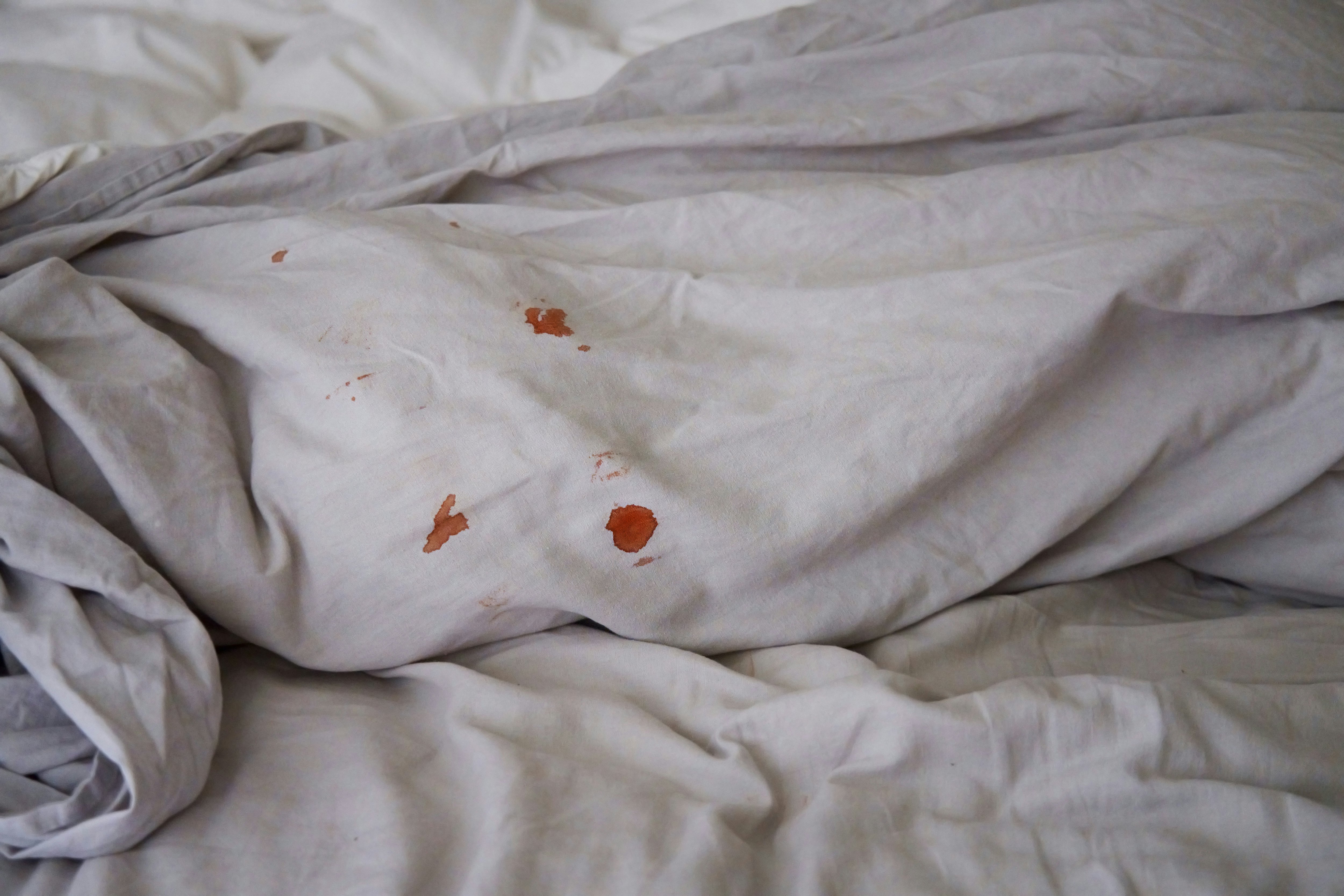 11 Reasons For Bleeding During Or After Sex, Explained By Experts image pic