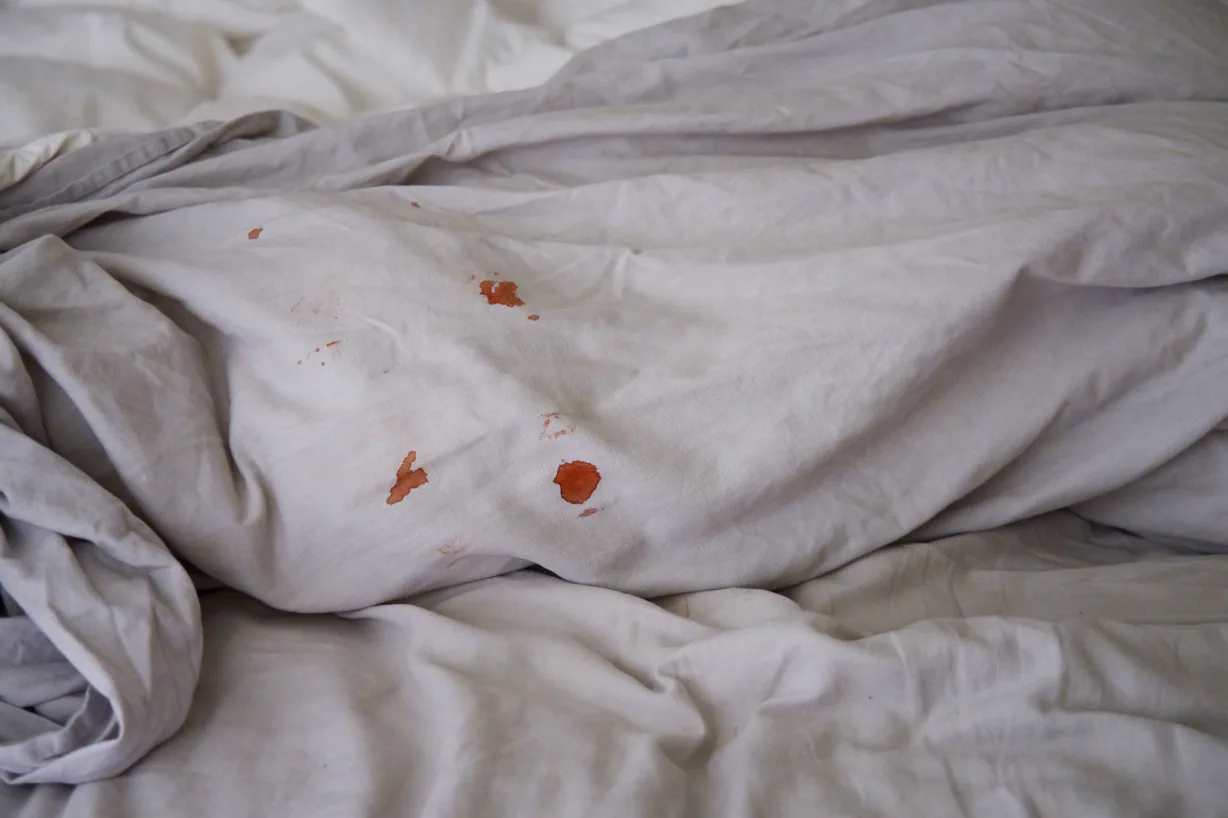 11 Reasons For Bleeding During Or After Sex, Explained By Experts