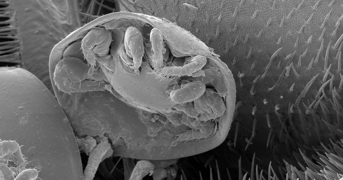 Human Body Insectivorous Why flesh-eating bugs are the real MVPs for humanity’s survival