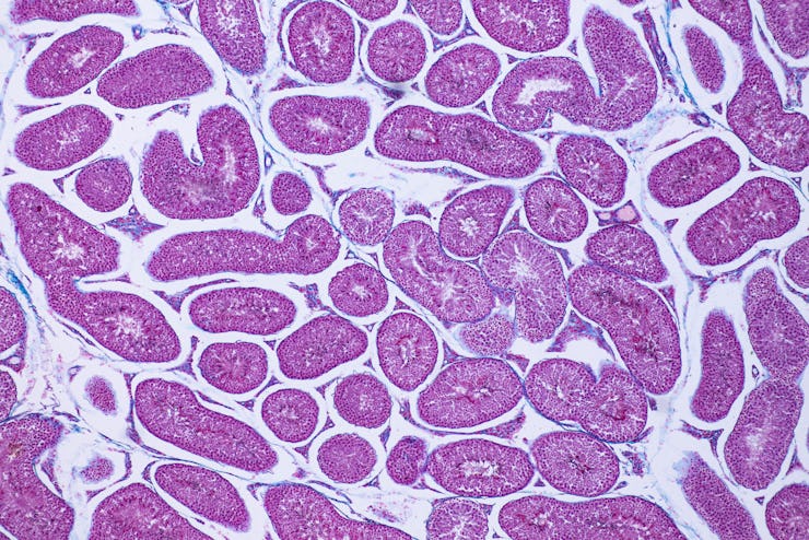 Human testis, light micrograph. Cross-section showing spermatogonia, spermatocytes in meiosis, sperm...