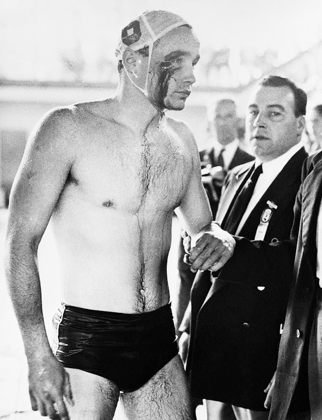 (Original Caption) 12/8/1956-Melbourne, Australia- 1956 OLYMPICS- PLAYER INJURED IN WATER POLO BRAWL...