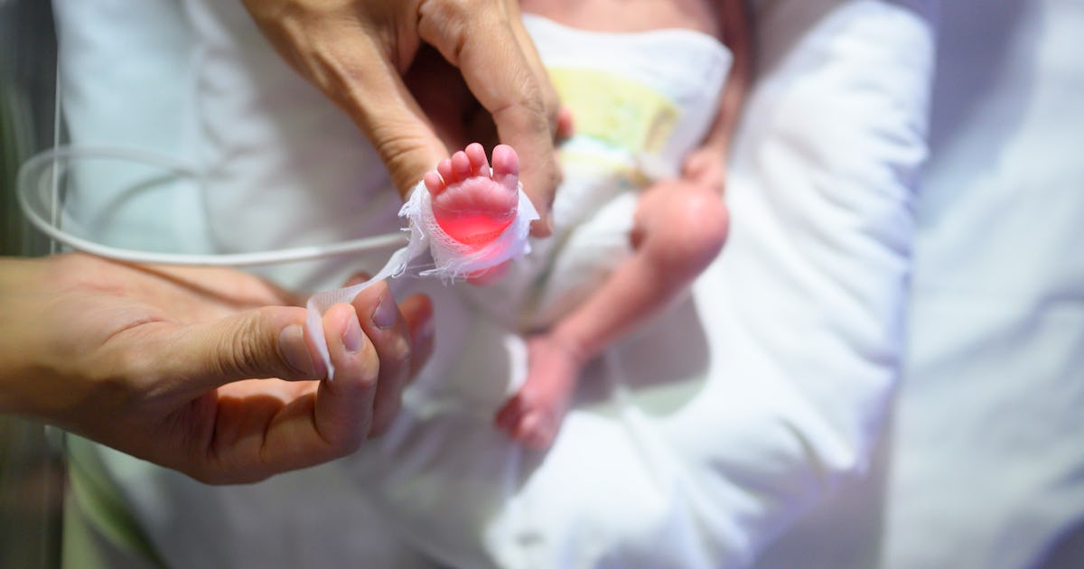 Micro Preemies: Survival Rates, Risks, Breastfeeding Advice, & More