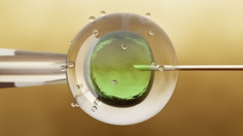 IVF (in vitro fertilization) or insemination of female egg with microscope