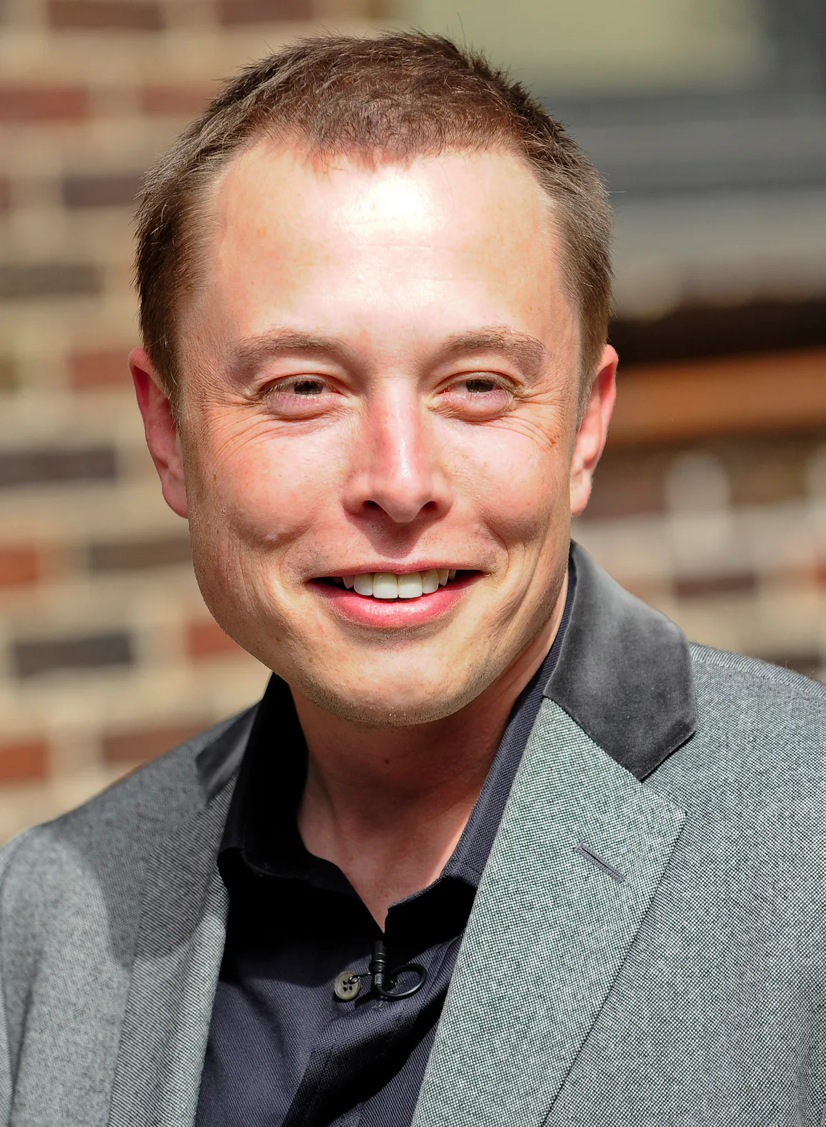 Where Art Thou Hair Transplants? – Celebrity Land International