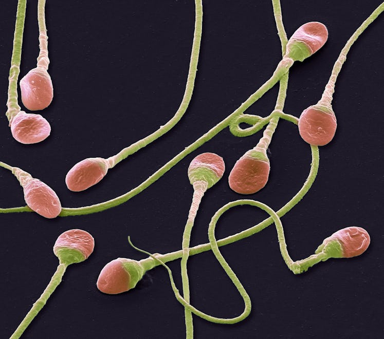 Sperm cells. Coloured scanning electron micrograph (SEM) of human sperm cells or spermatozoa. These ...