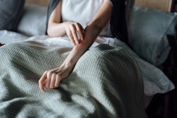 Cropped shot of young woman suffering from skin allergy, scratching her forearm with fingers