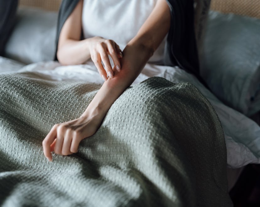 Cropped shot of young woman suffering from skin allergy, scratching her forearm with fingers