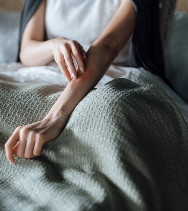 Cropped shot of young woman suffering from skin allergy, scratching her forearm with fingers