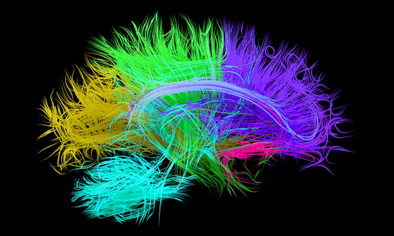 Illustration of human brain nerve tracts based on magnetic resonance imaging (MRI) data.