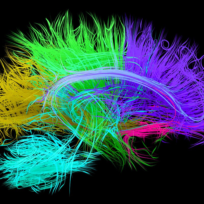 Illustration of human brain nerve tracts based on magnetic resonance imaging (MRI) data.