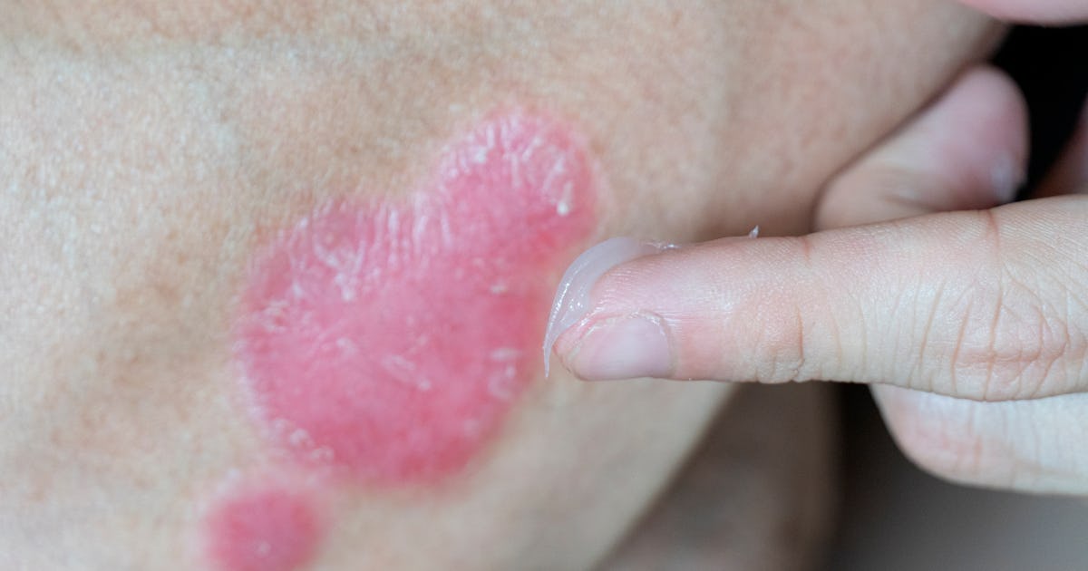 Inflammation Immune System Science Explains Why The Body Attacks Itself inflammation-immune-system-science-explains-why-the-body-attacks-itself