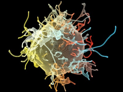 Cancer cells, computer illustration.