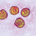 Hepatitis C virus (close to the Flavivirid family). HCV causes blood-borne hepatitis, cirrhosis occu...