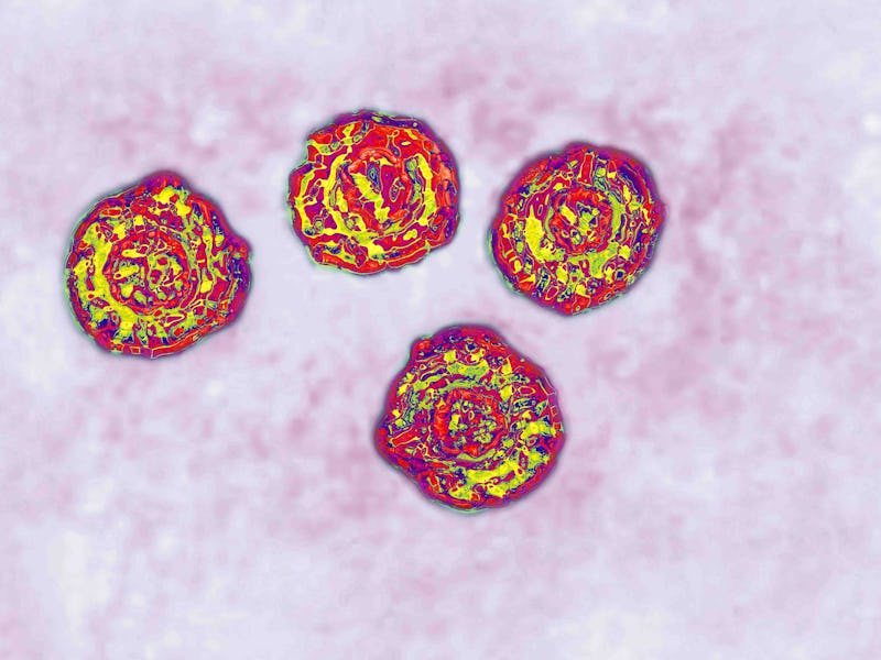 Hepatitis C virus (close to the Flavivirid family). HCV causes blood-borne hepatitis, cirrhosis occu...