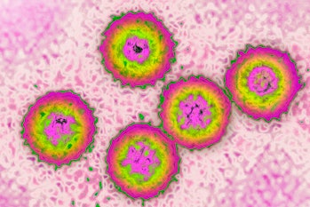 Cytomegalovirus, it causes a mononucleosis syndrome. Image produced from an image taken with transmi...