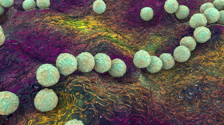 External Strep What is invasive strep A? The potentially dangerous condition is ...